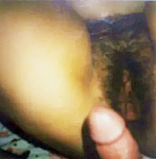 Pic #1FAT HAIRY